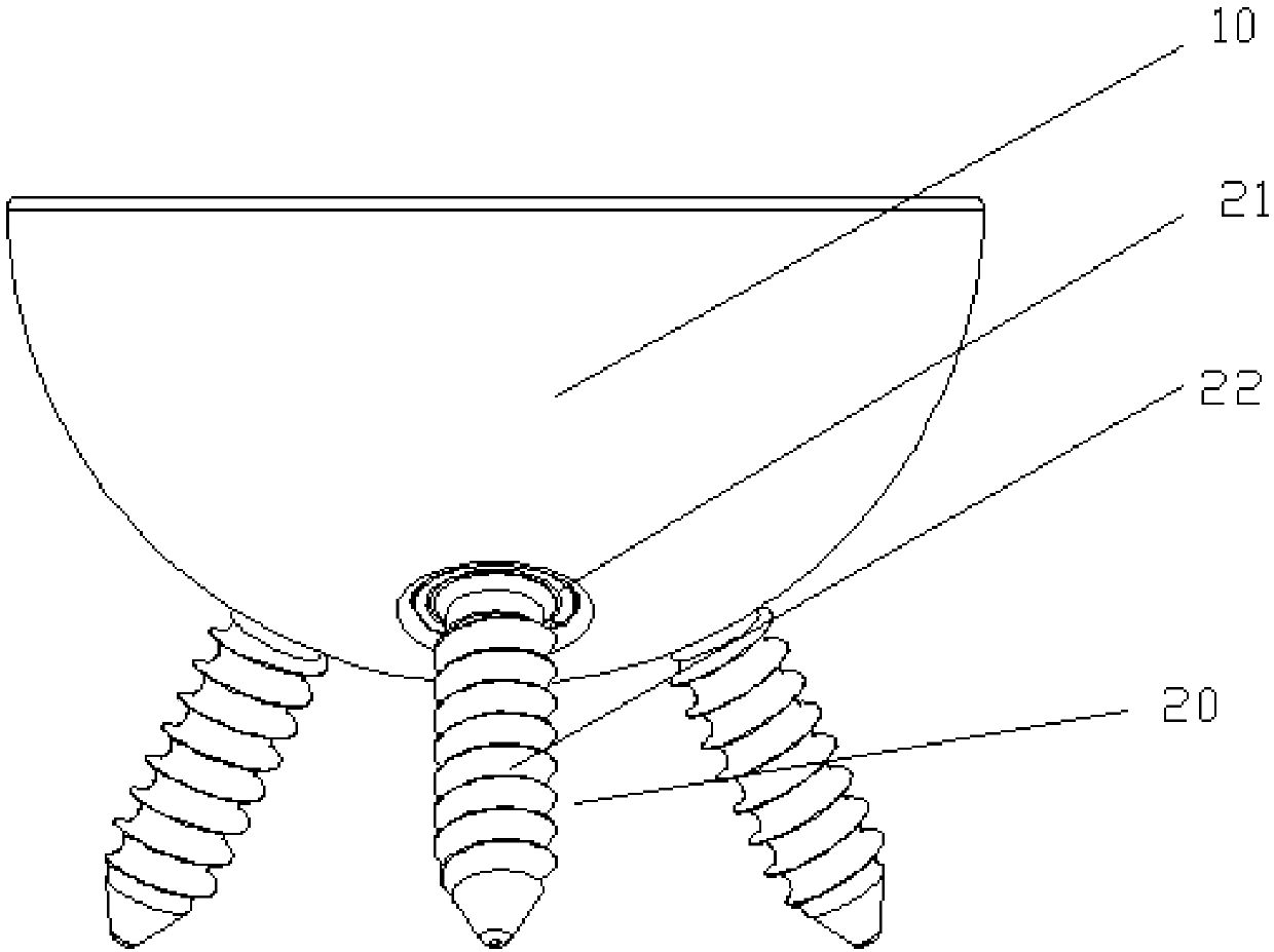 Acetabular prosthesis