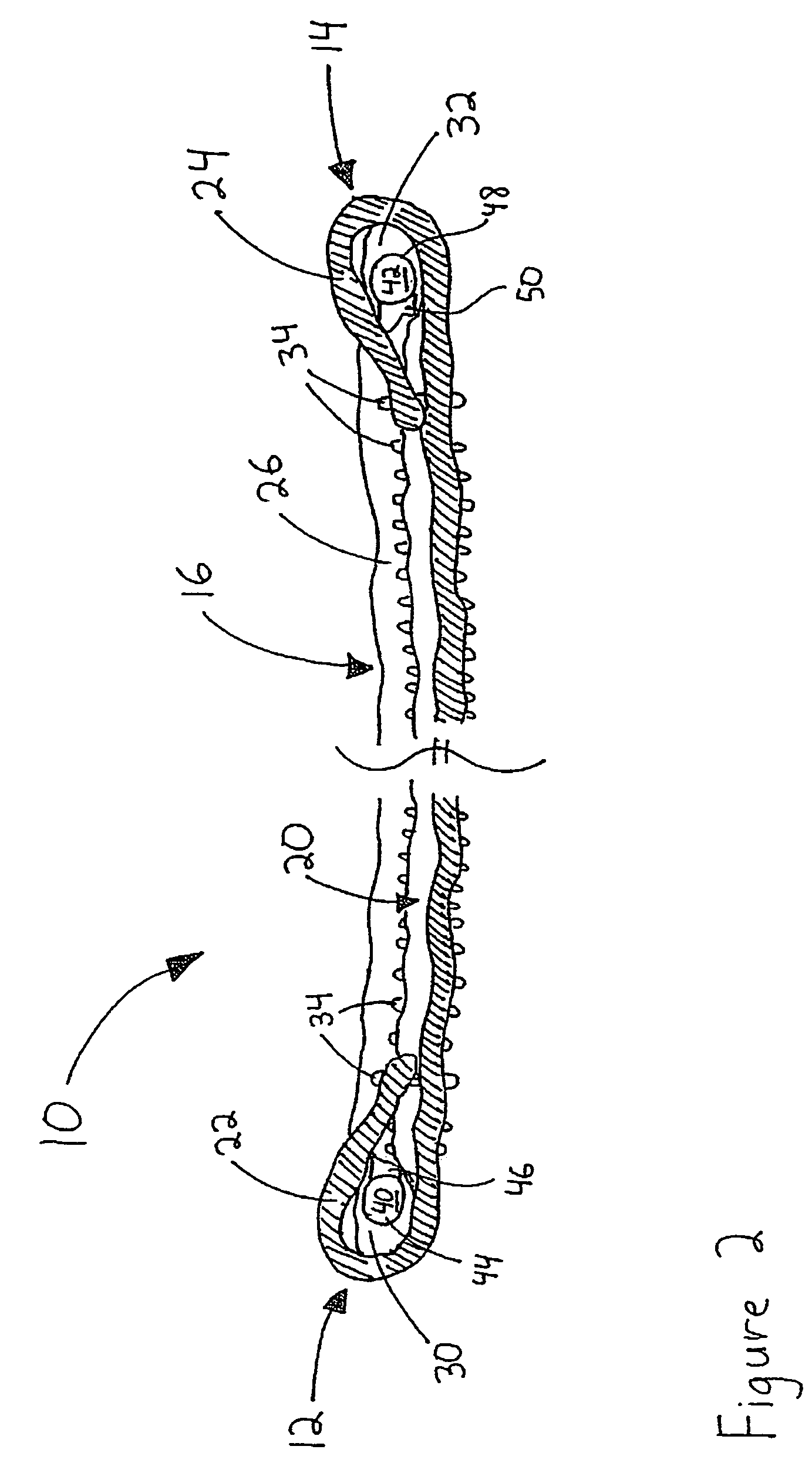 Surgical towel having radiopaque element and methods for making same
