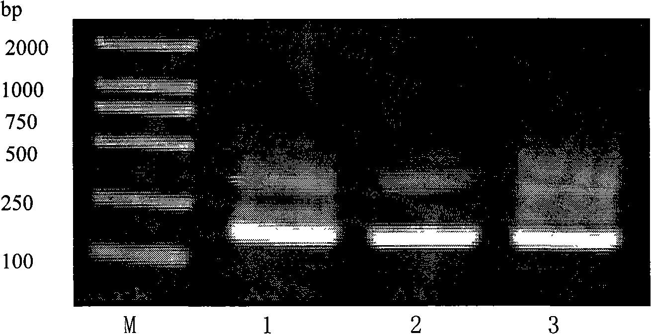 Multi-type HCV-E1 epitope complex immunogen, encoding gene and application thereof