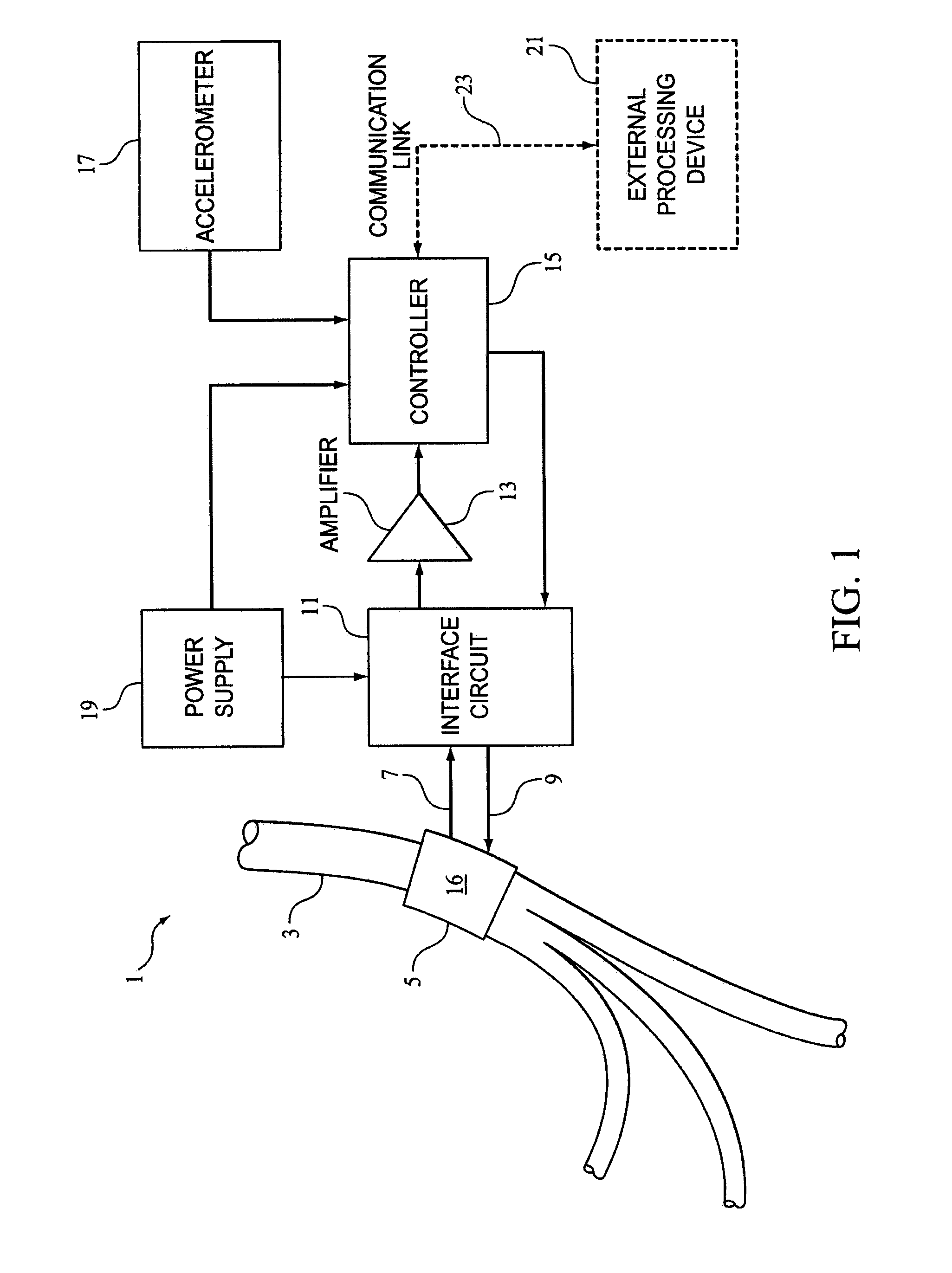 Method and apparatus for hypoglossal nerve stimulation