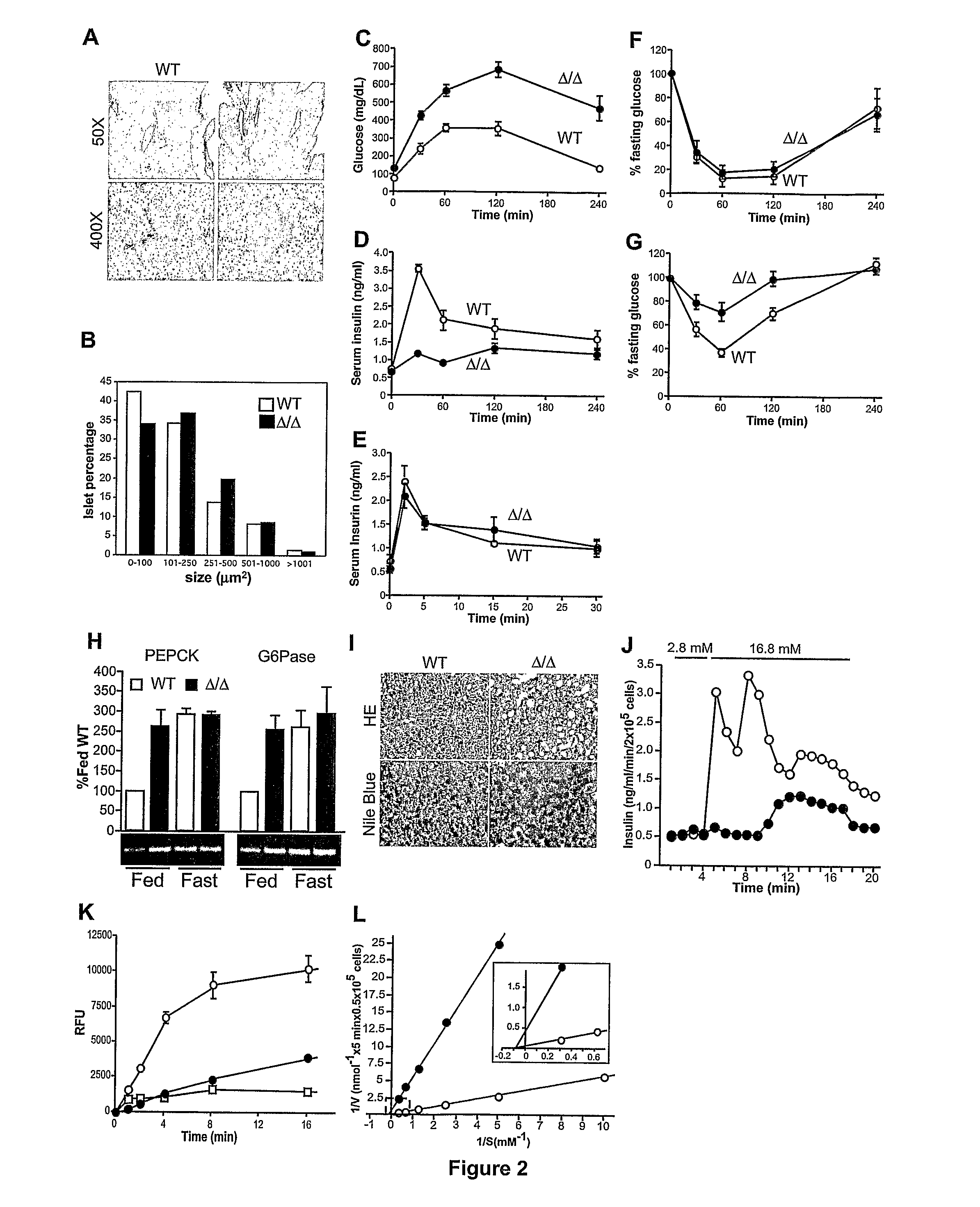 Regulation of glucose and insulin levels by GnT-4 glycosyltransferase activity