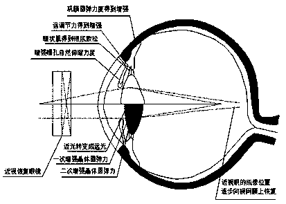 Vision recovery instrument