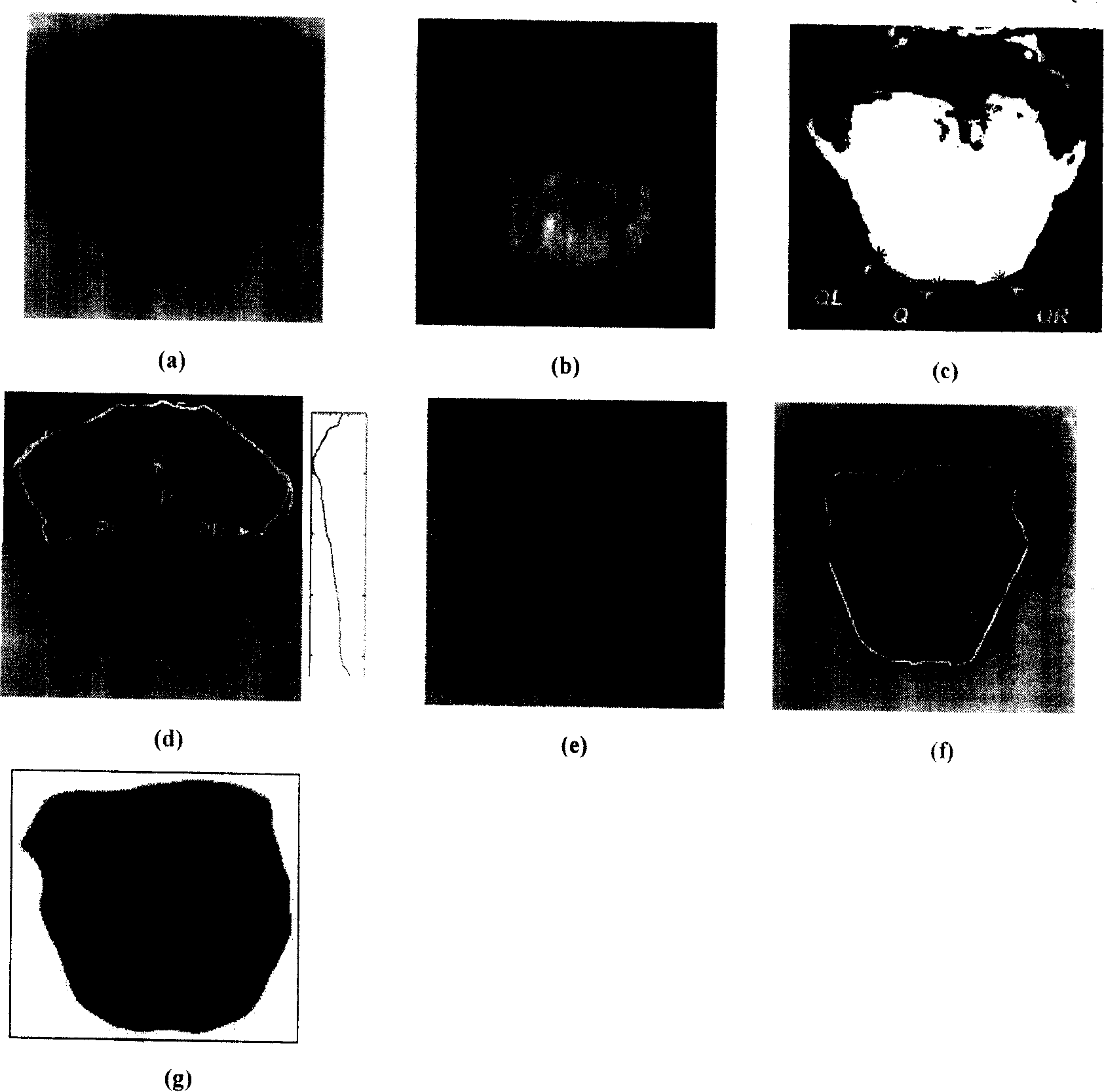 Method for extracting tongue body from tongue images