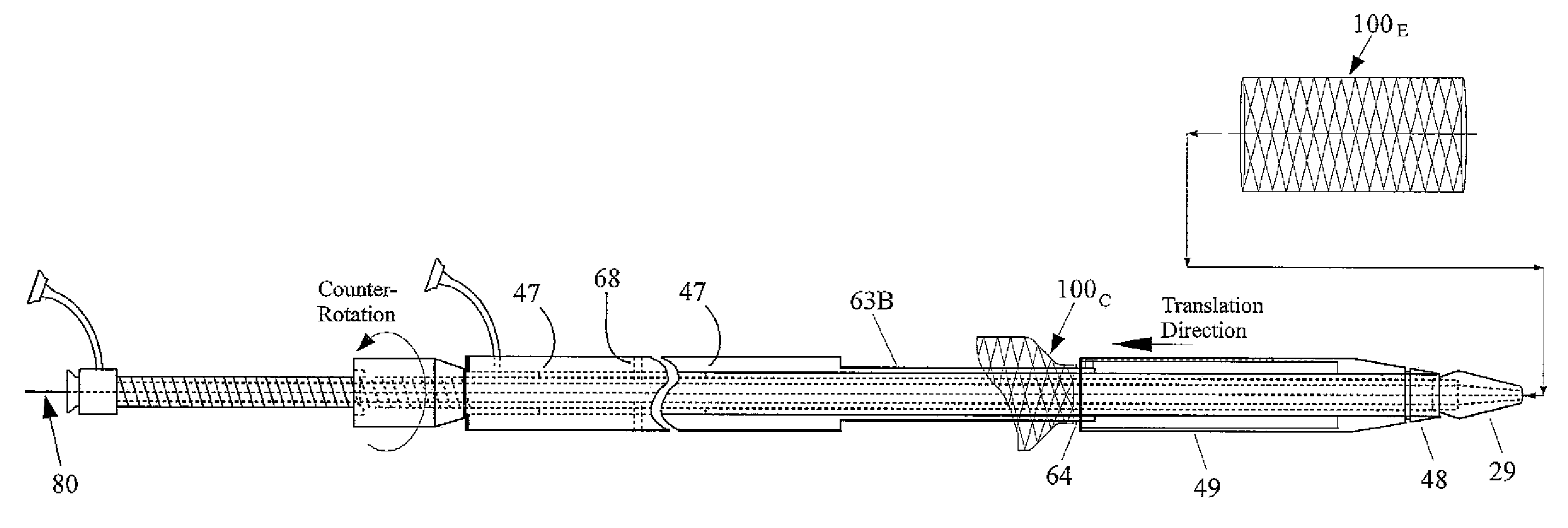 Apparatus And Method for Proximal-to-Distal Endoluminal Stent Deployment