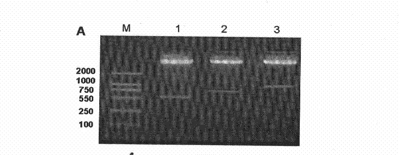 Recombinant BCG vaccine based on human MUC1 repetitive sequence and GM-CSF fusion expression