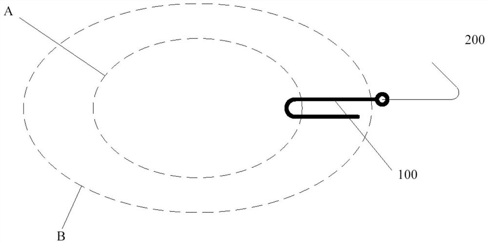 Single-hole capsular retractor and preparation method thereof