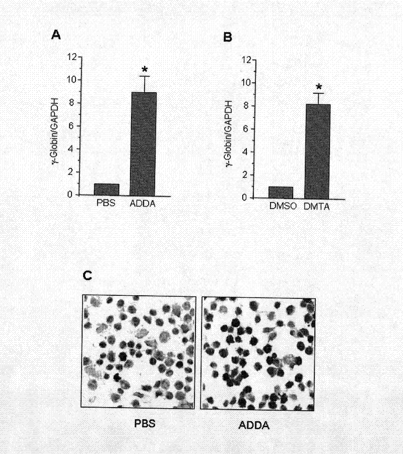 Application of ADDA and/or DMTA in preparing medicine for improving expression level of gamma-globin