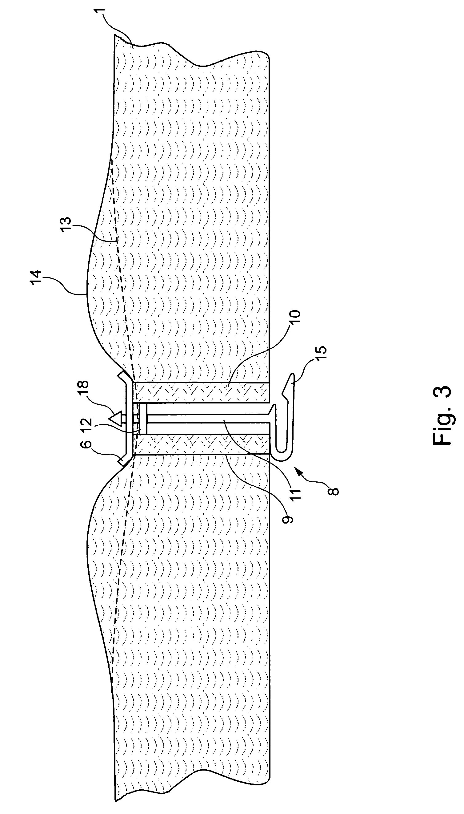 Insulation of an aircraft fuselage structure