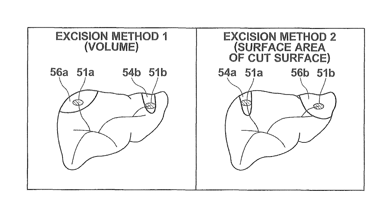 Surgery assistance apparatus, surgery assistance method and non-transitory computer-readable recording medium having stored therein surgery assistance program