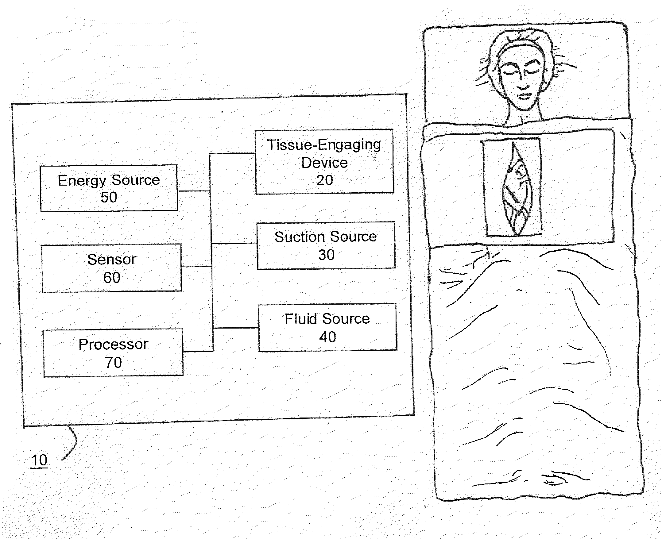 Method and System for Organ Positioning and Stabilization