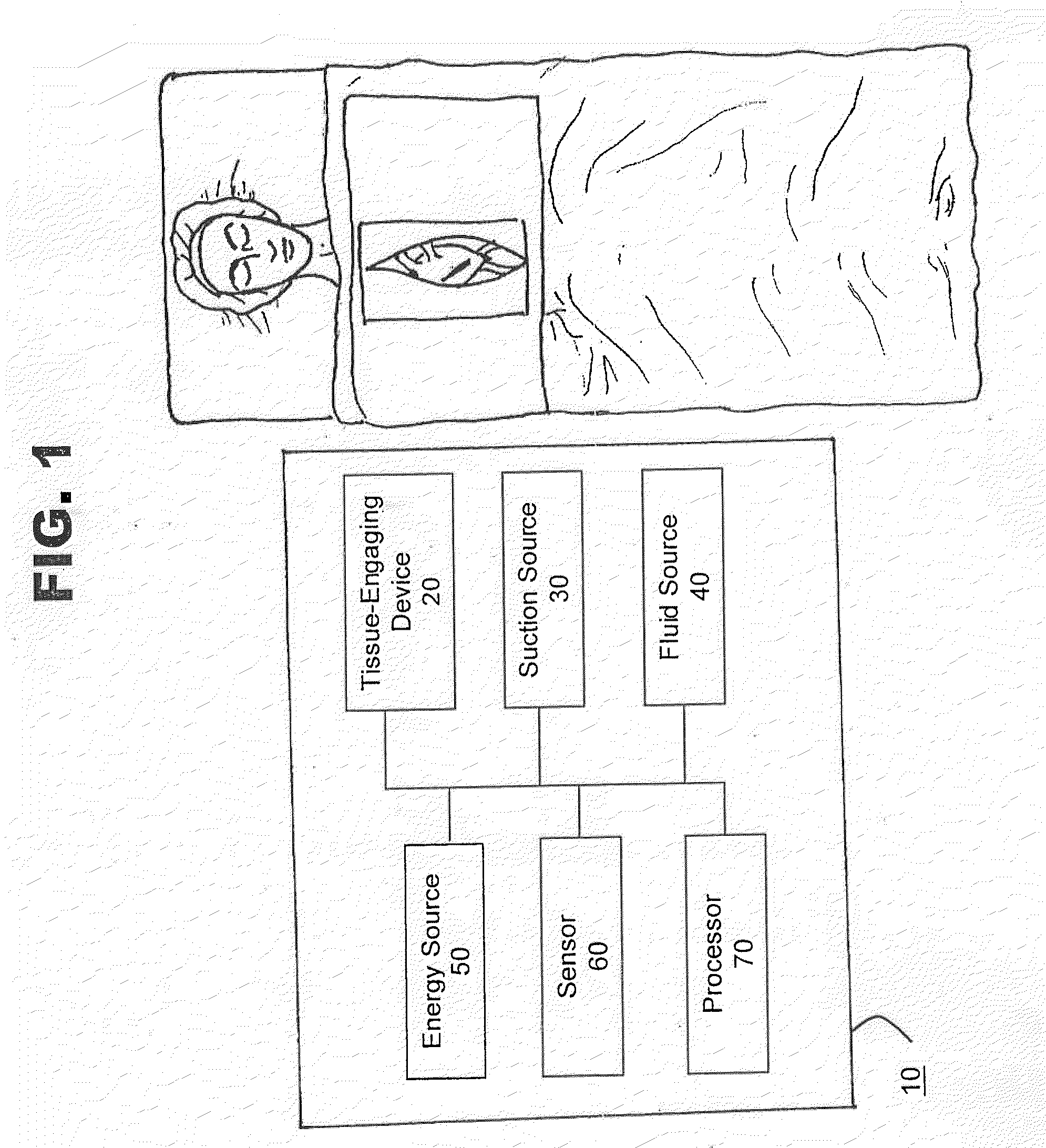 Method and System for Organ Positioning and Stabilization