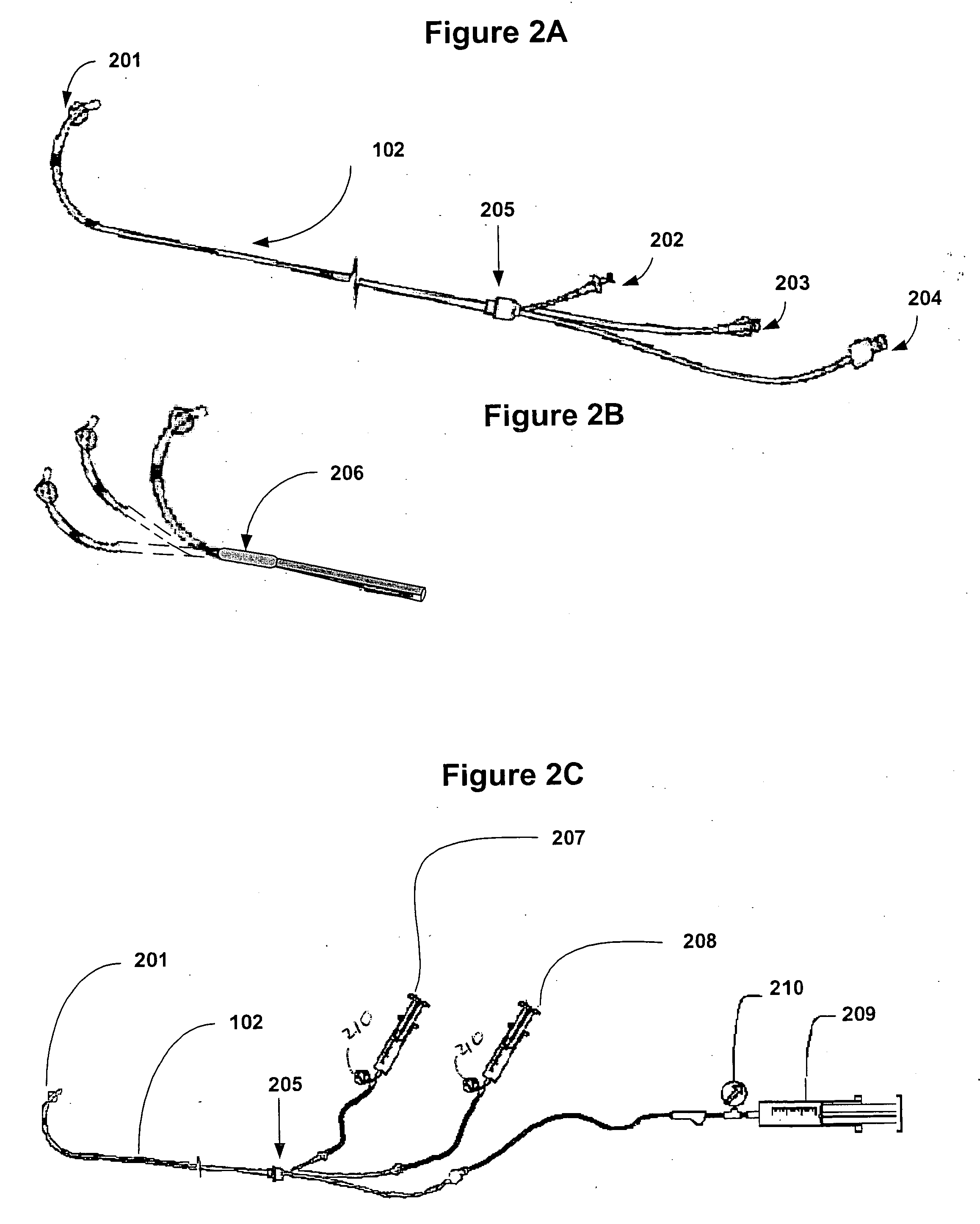 Biodegradable pericardia constraint system and method