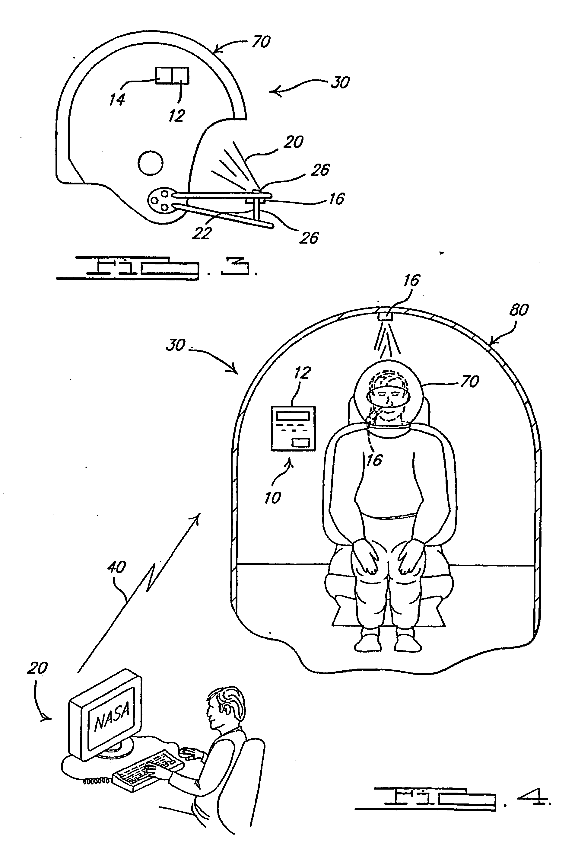 System and method of active neuro-protection for detecting and arresting traumatic brain injury and spinal cord injury
