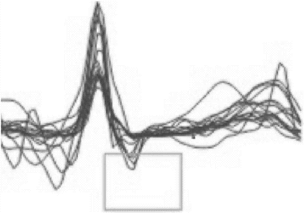 An electrocardiogram data display method and a terminal apparatus