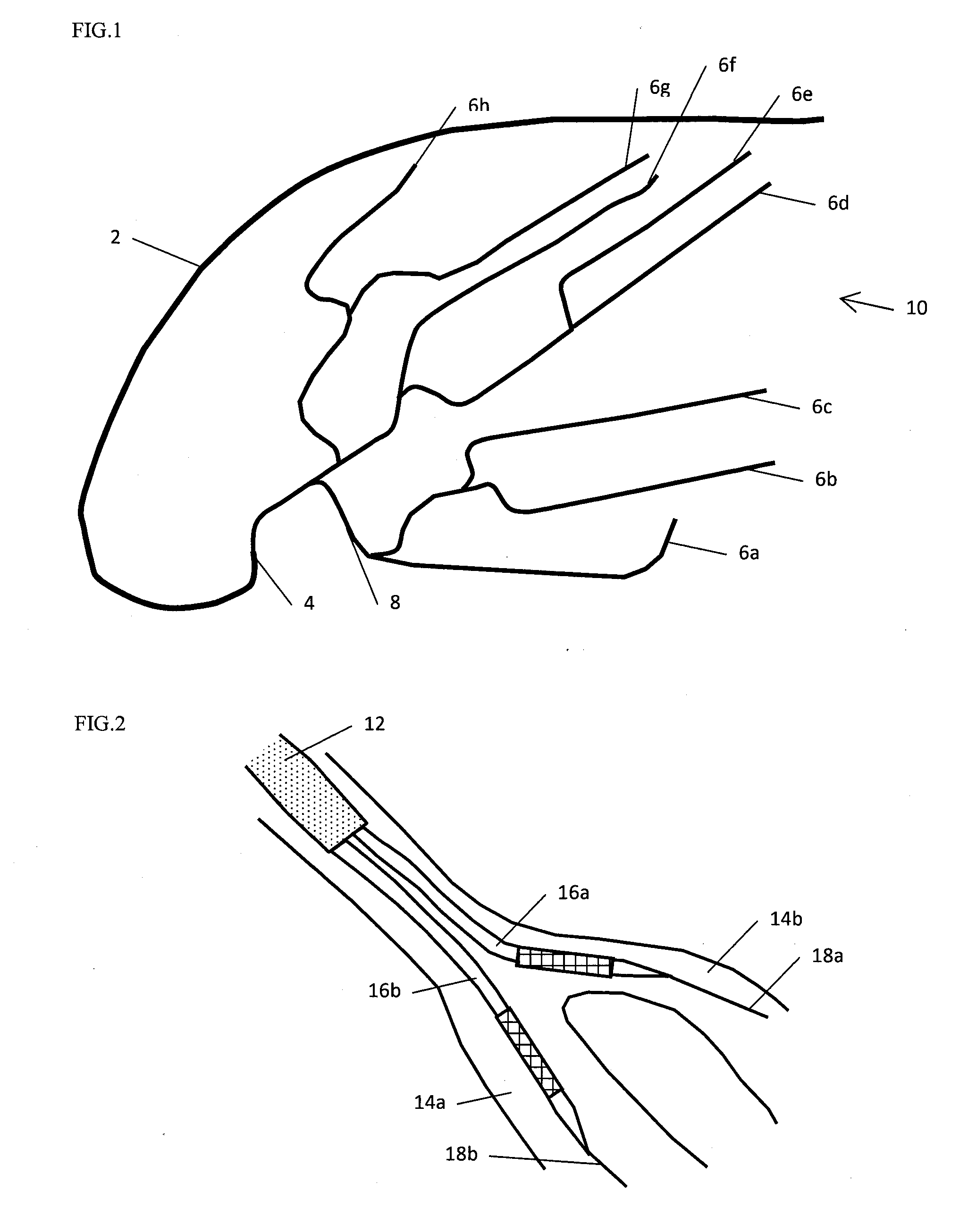 Stent and stent delivery system with improved deliverability