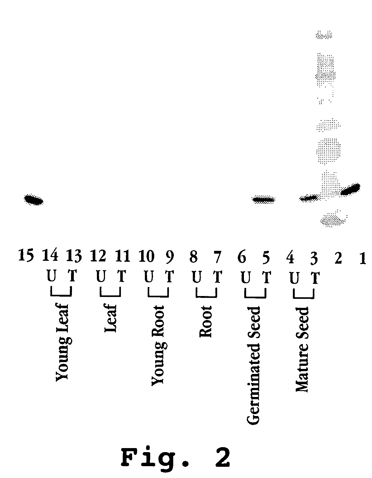 Expression of human milk proteins in transgenic plants