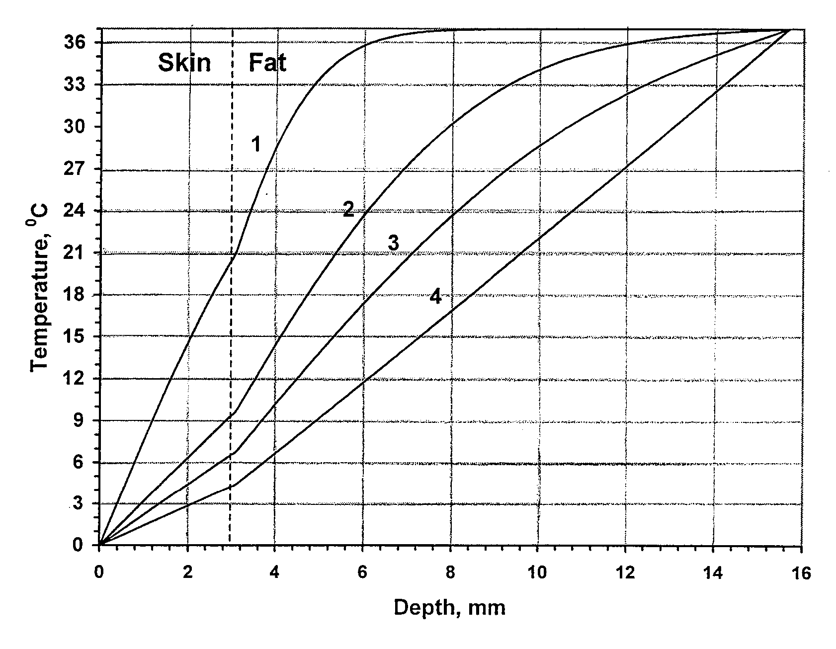 Method and apparatus for treatment of cutaneous and subcutaneous conditions