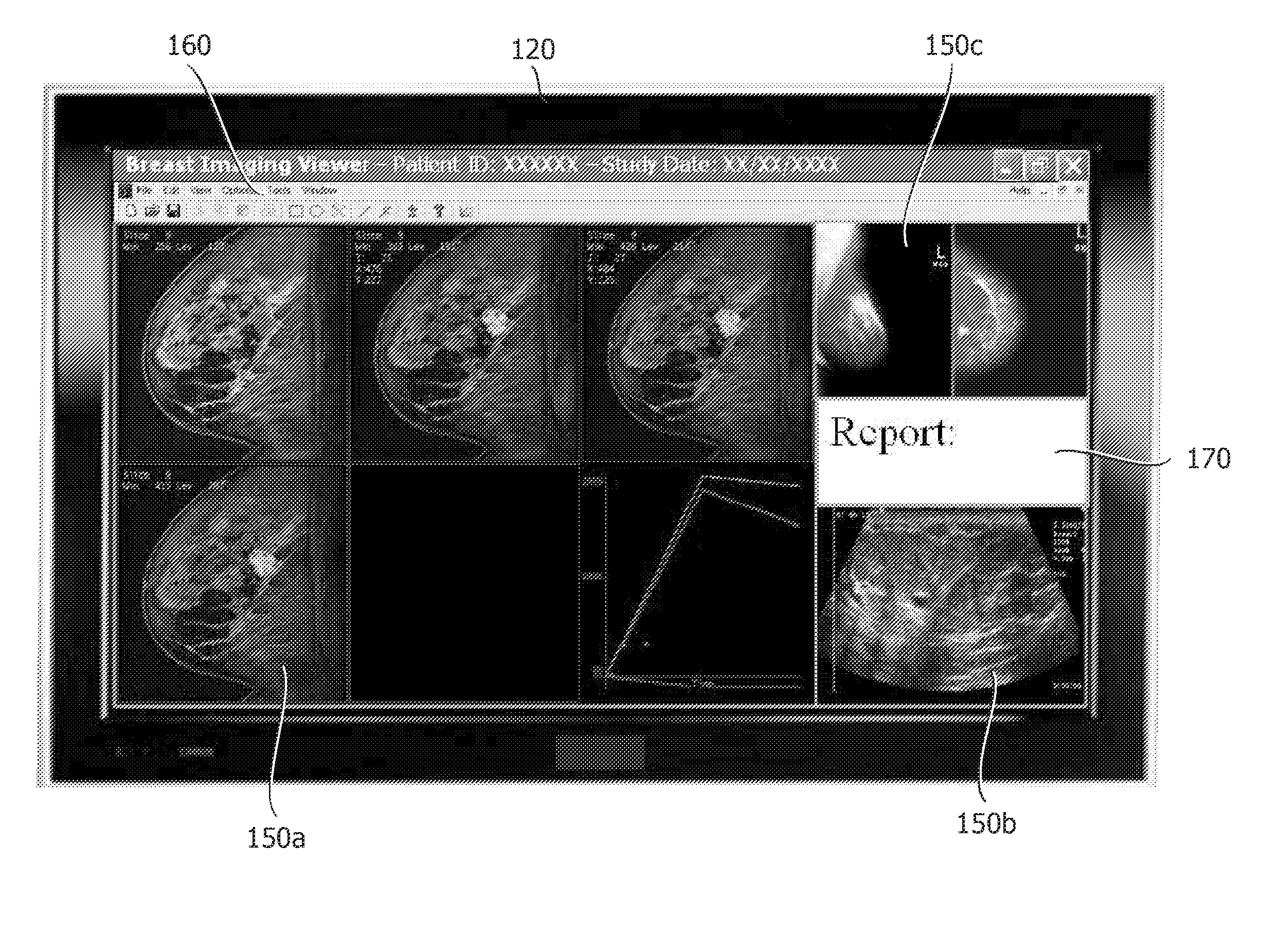 Multiple modality computer aided diagnostic system and method