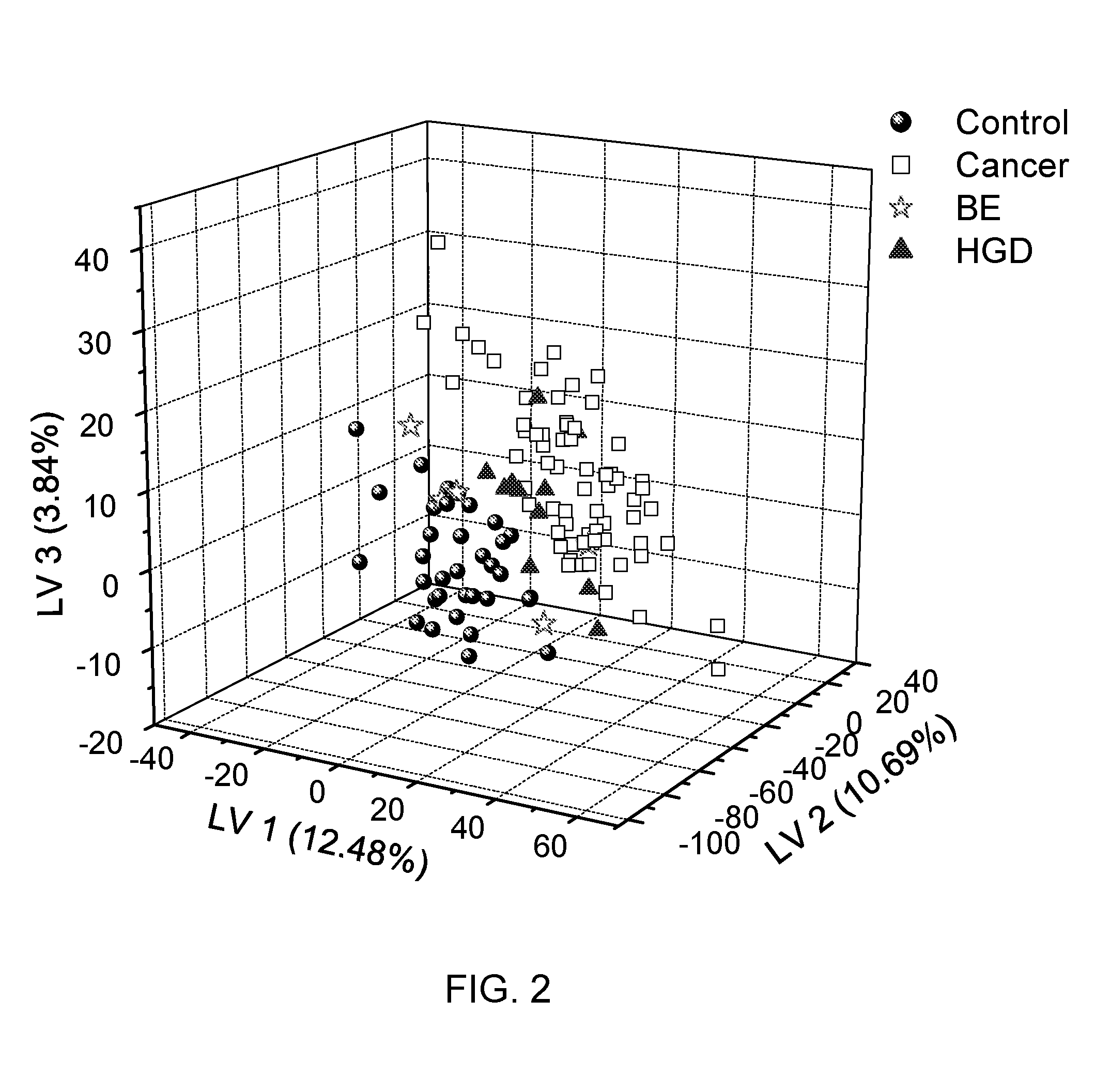 Metabolite Biomarkers for the Detection of Esophageal Cancer Using NMR