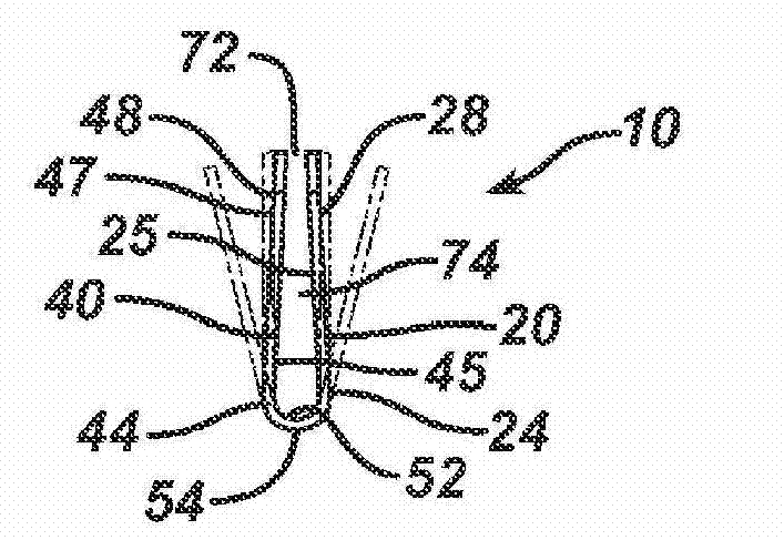 Columellar strut for nasal tip support