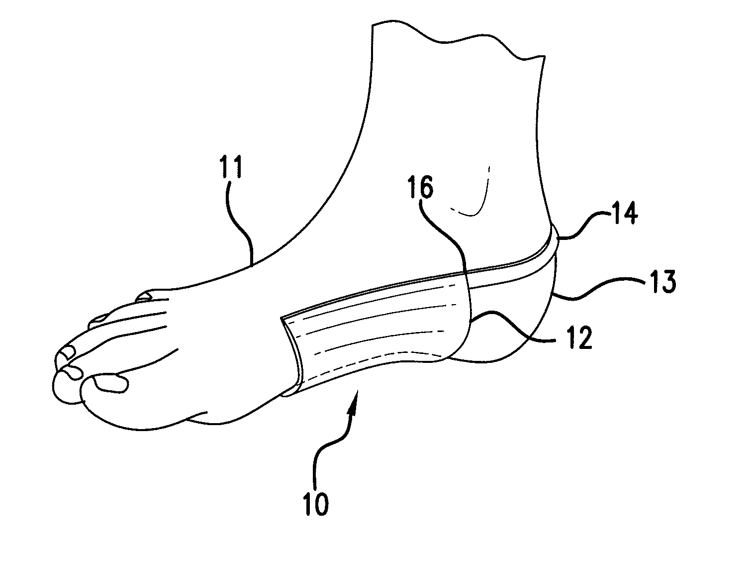 Arch strap and method for treating heel pain
