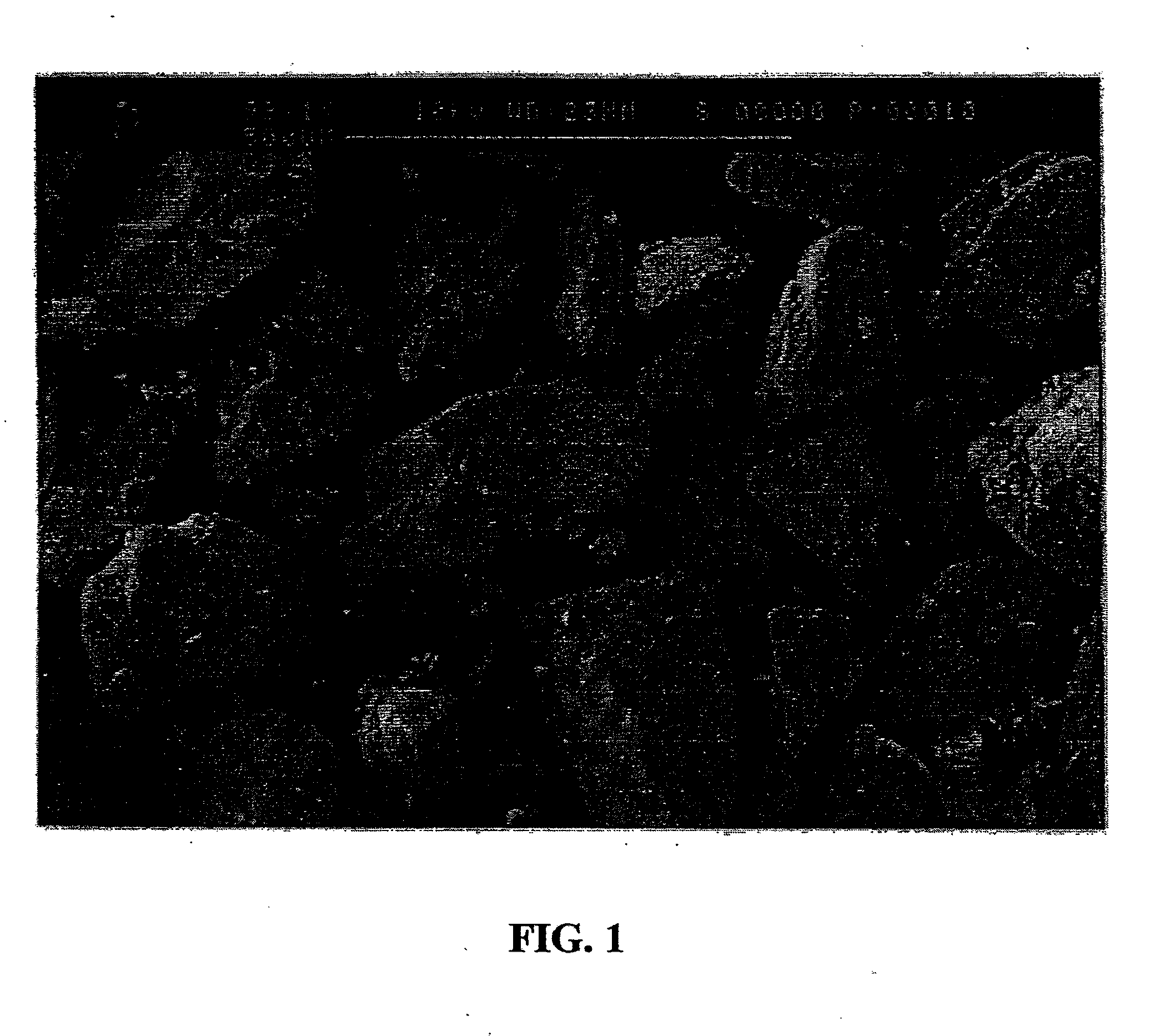 Method for Purification of Lactose