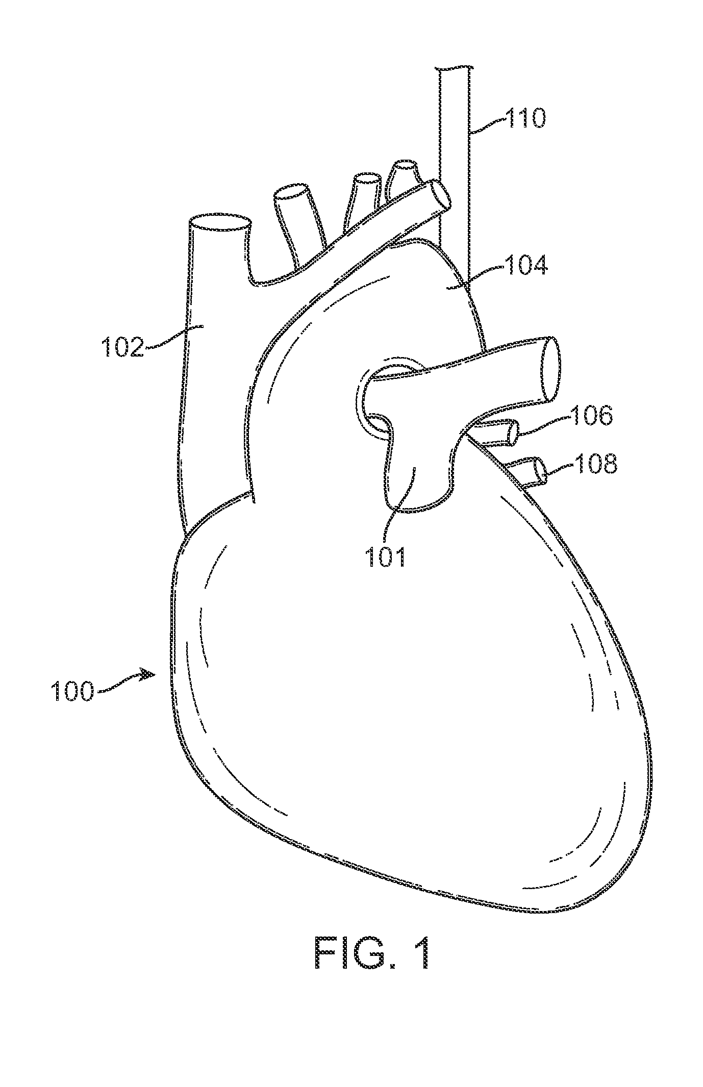 Method to protect the esophagus and other mediastinal structures during cardiac and thoracic interventions