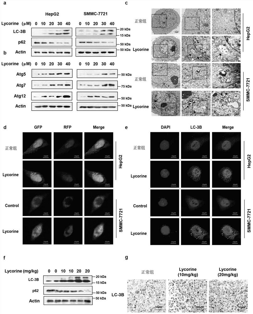 Application of the agent for reducing the expression or activity of lc-3b in the preparation of a drug that enhances lycorine's anti-liver cancer activity