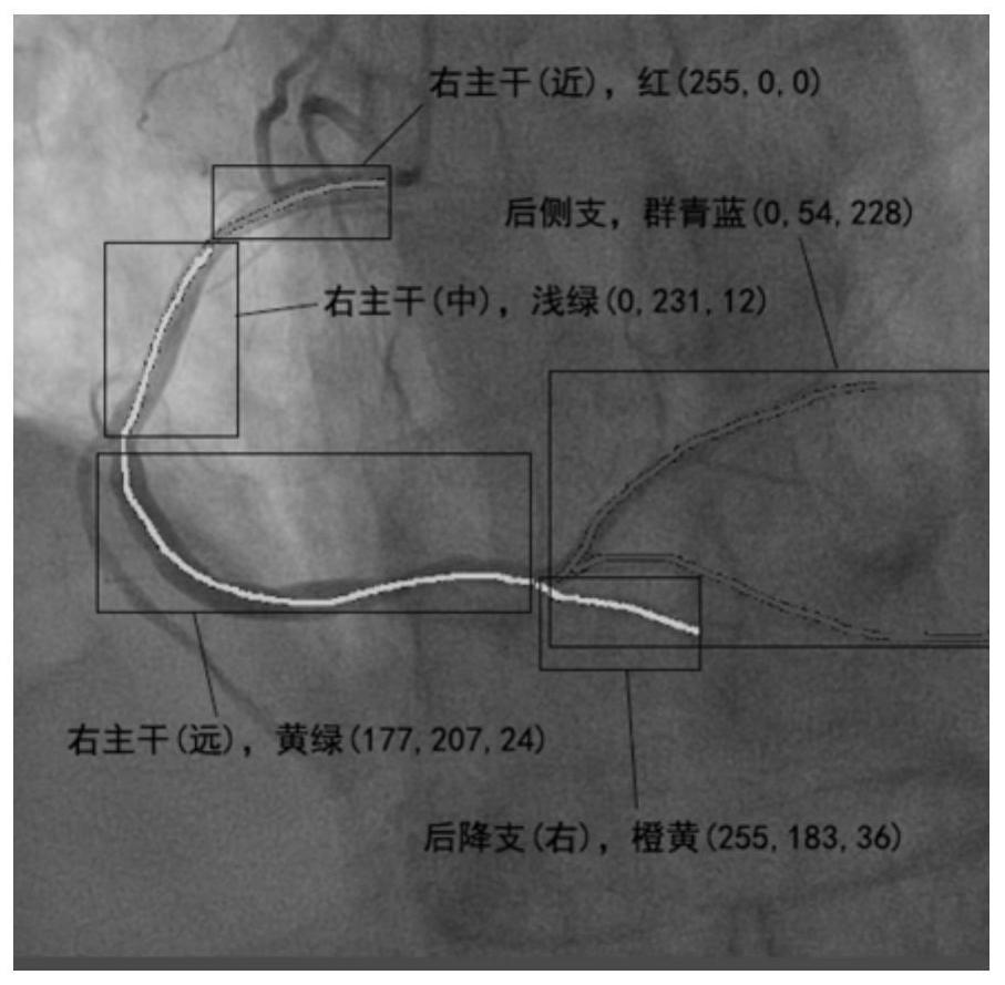 Method for Rapidly Constructing Cardiac Coronary Vessel Identification Dataset