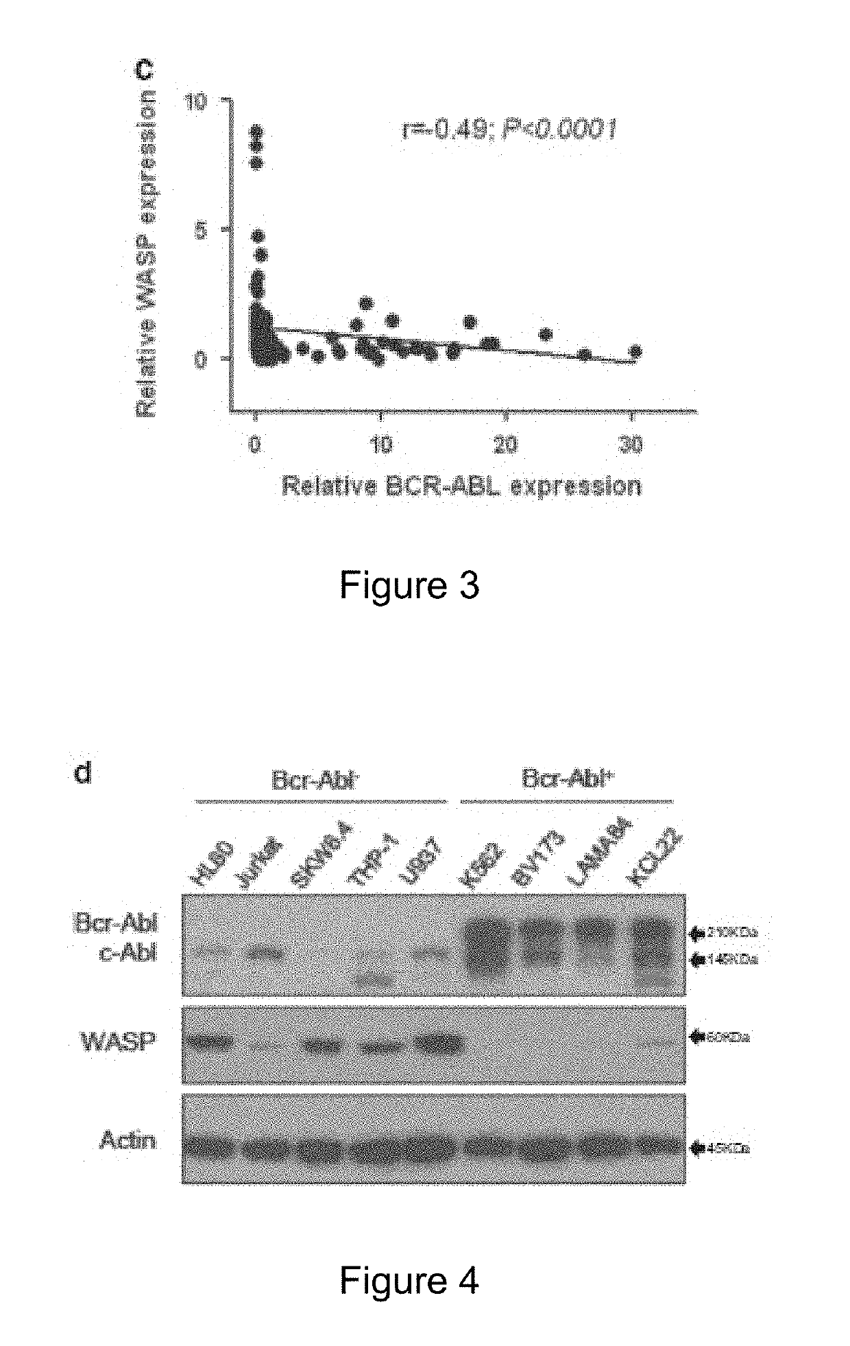 Use Of Wiskott-Aldrich Syndrome Protein (WASP) As A Biological Marker And In Vitro Method For Monitoring The Progression Of A Hematological Disease