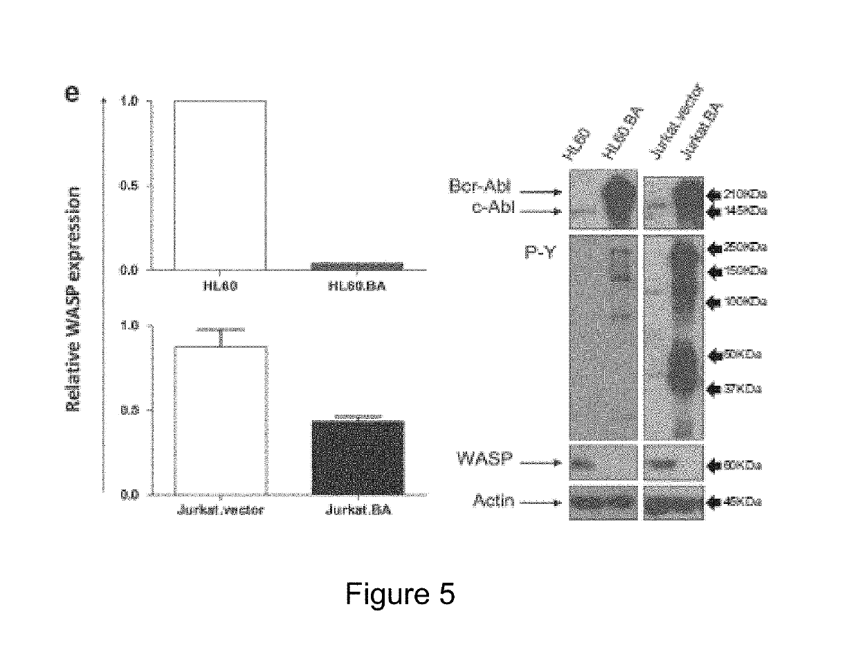 Use Of Wiskott-Aldrich Syndrome Protein (WASP) As A Biological Marker And In Vitro Method For Monitoring The Progression Of A Hematological Disease