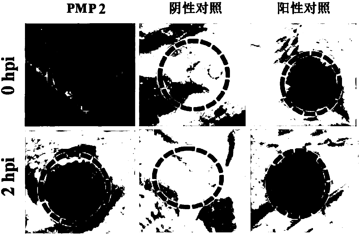 A Phytophthora inducible synthetic promoter pmp2 and its recombinant expression vector and application