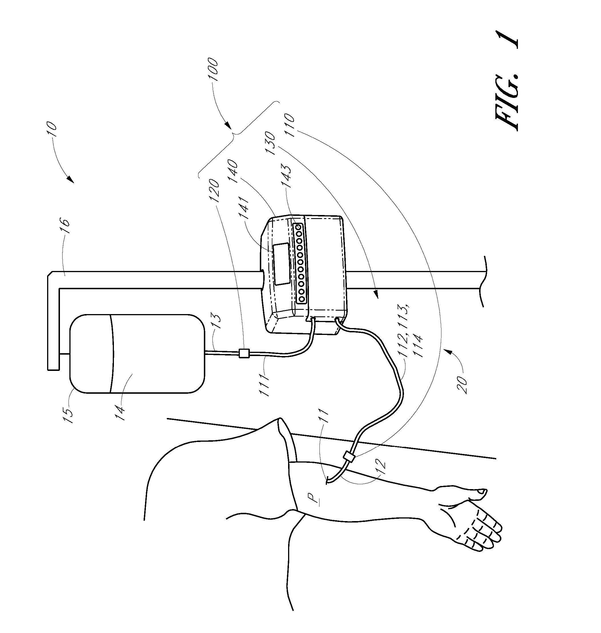 Analyte detection system with periodic sample draw and body fluid analyzer