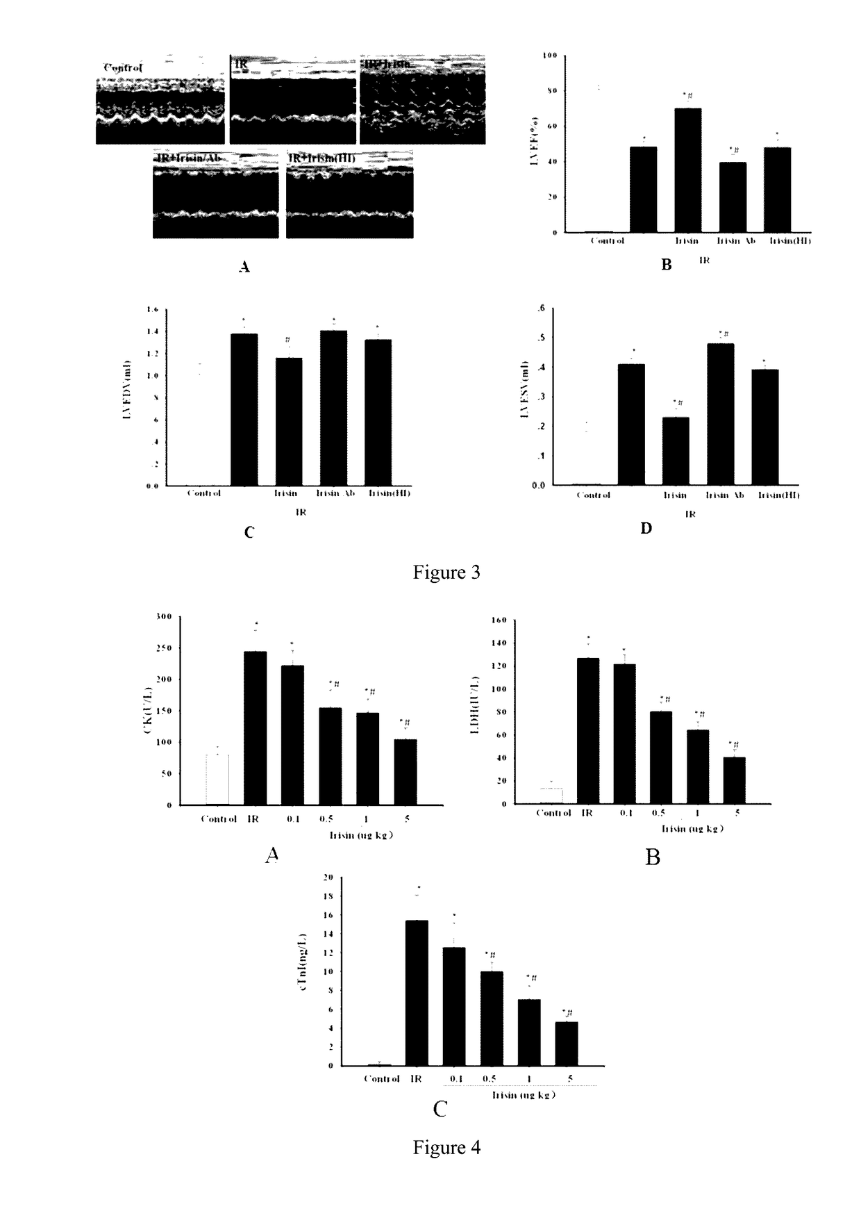 Application of irisin in myocardial ischemia reperfusion