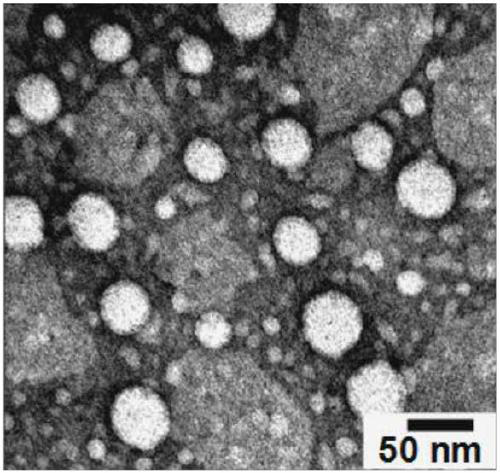 Contrast agent based on iopamidol lipid derivative and its preparation method and use