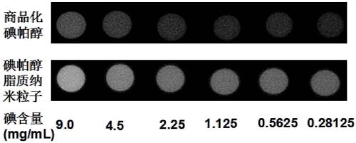 Contrast agent based on iopamidol lipid derivative and its preparation method and use