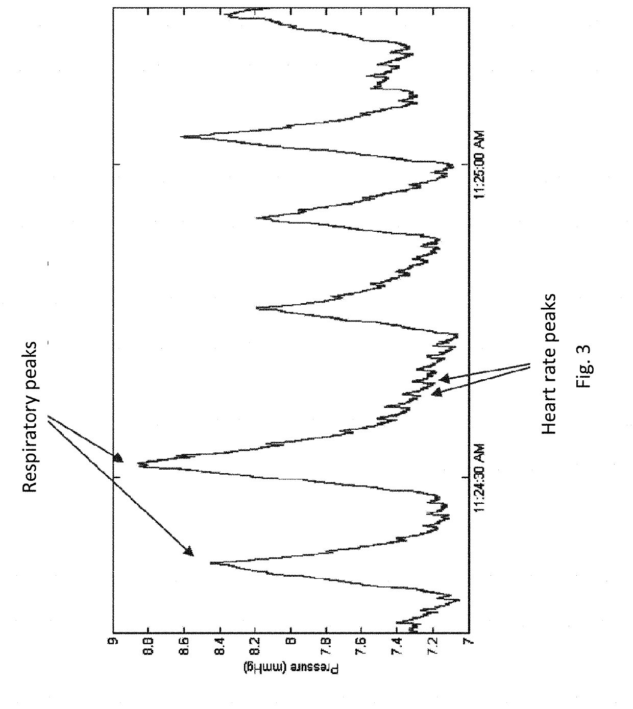 Systems, devices and methods for draining and analyzing bodily fluids