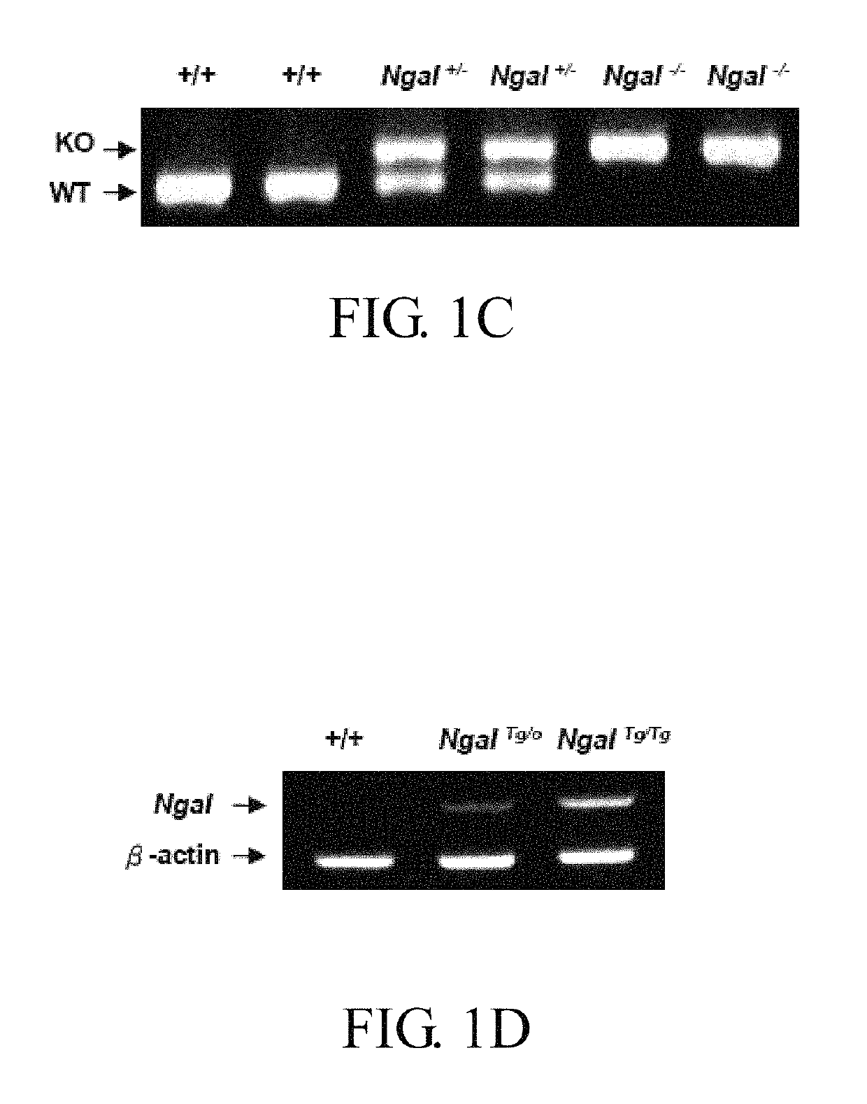 Method of preventing polycystic kidney disease and PKD animal model with exogenous neutrophil gelatinase-associated lipocalin