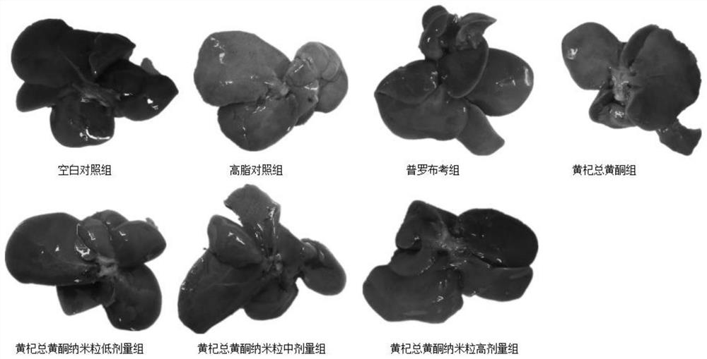 Application of chitosan engelhardia roxburghiana total flavone nanoparticles in preparation of medicines or health foods