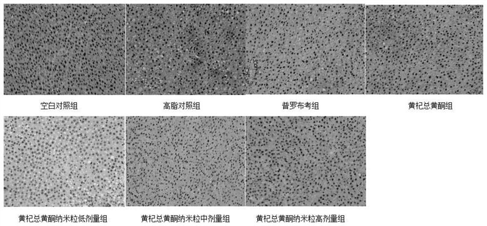 Application of chitosan engelhardia roxburghiana total flavone nanoparticles in preparation of medicines or health foods