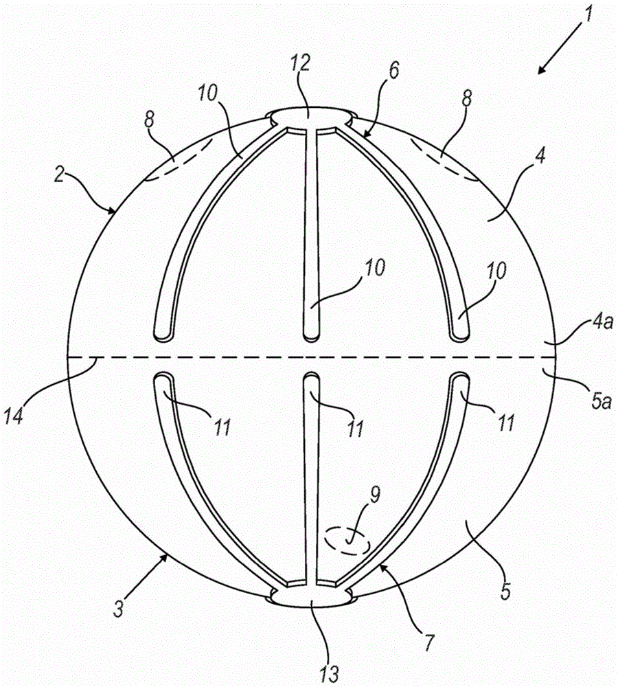 in situ artificial bladder prosthesis