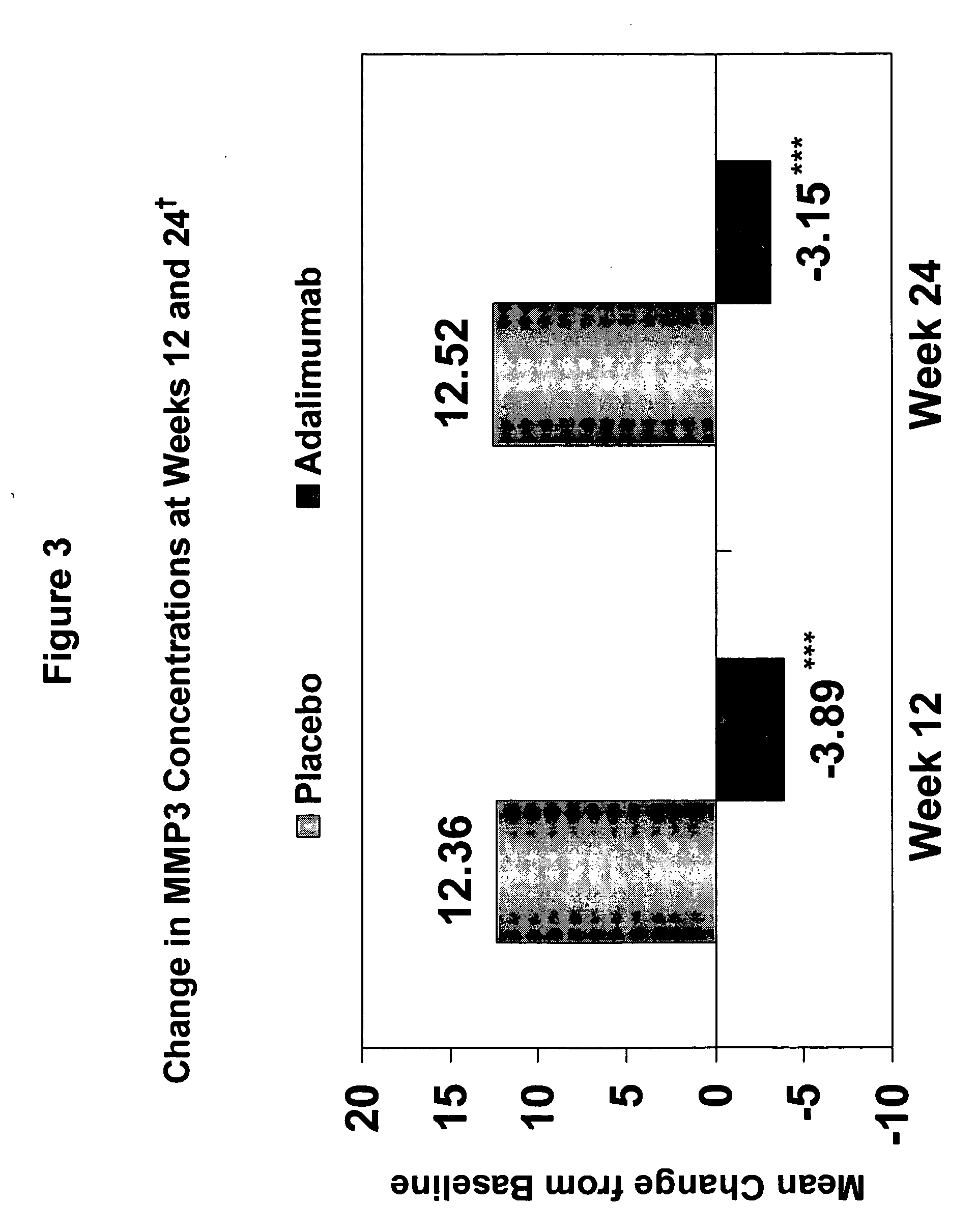 Methods and compositions for diagnosing ankylosing spondylitis using biomarkers