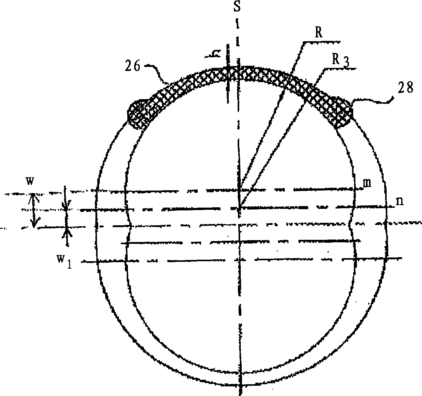 Heart valve prosthesis