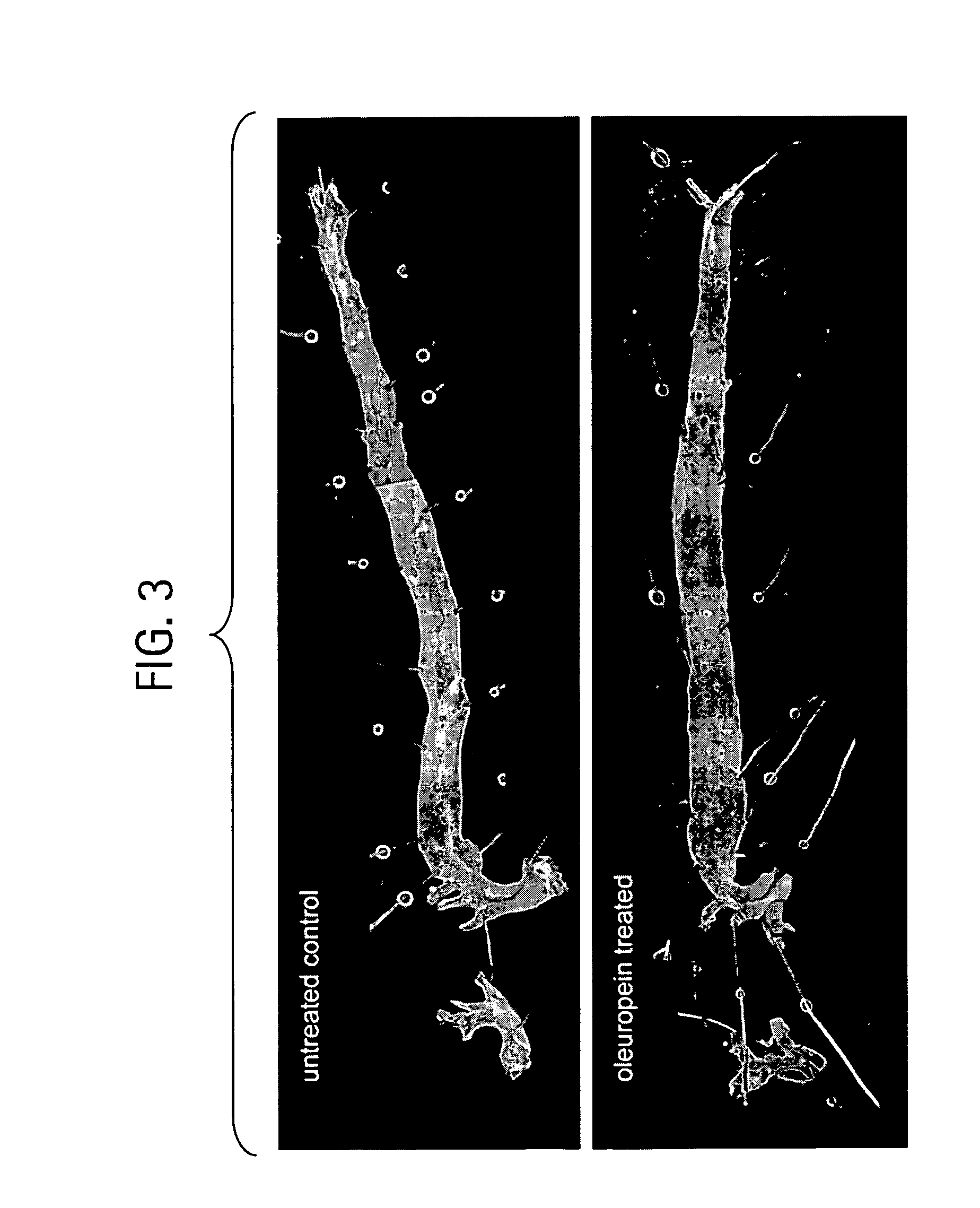 Compositions and methods for treating obesity, obesity related disorders and for inhibiting the infectivity of human immunodeficiency virus