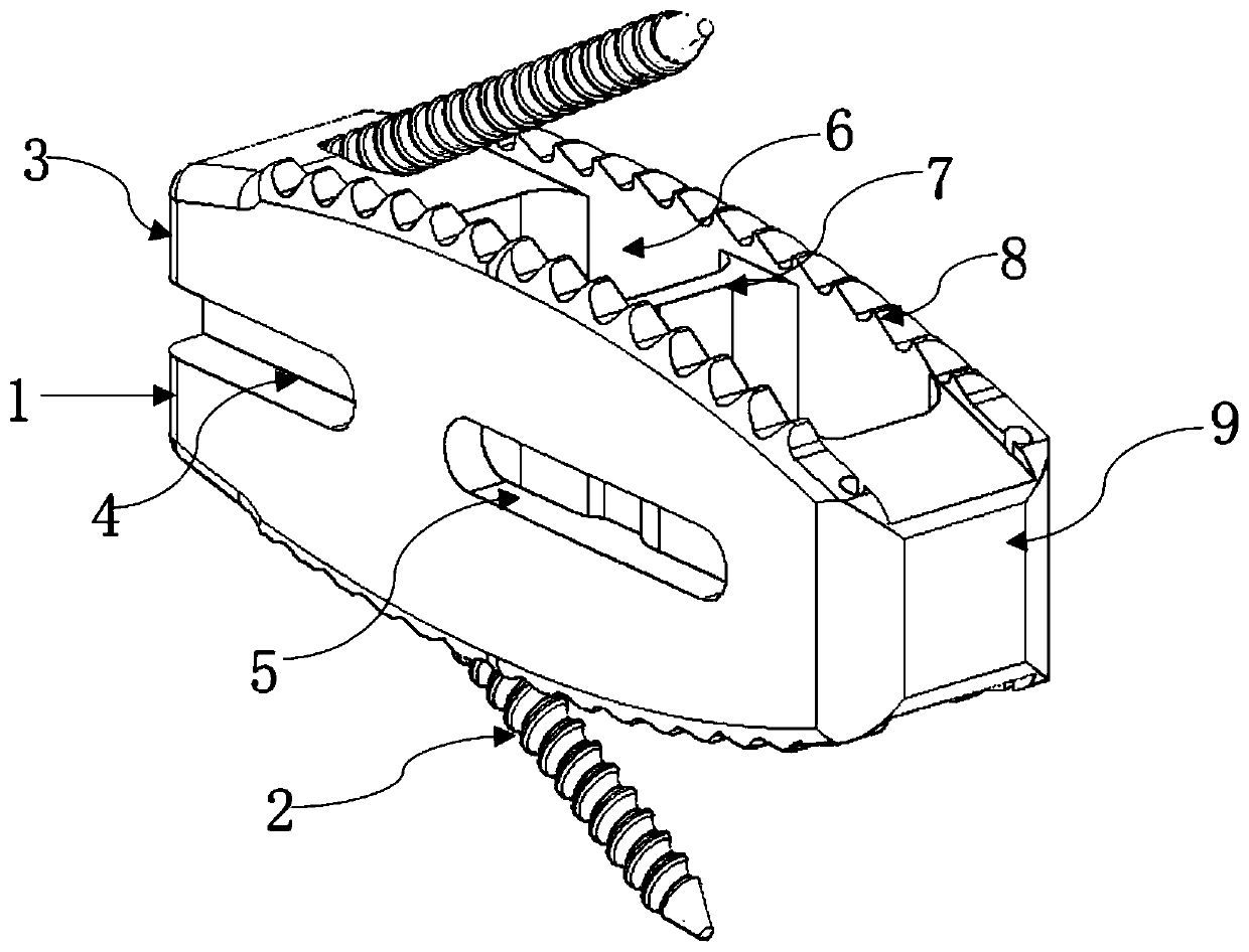 Posterior lumbar interbody fusion system