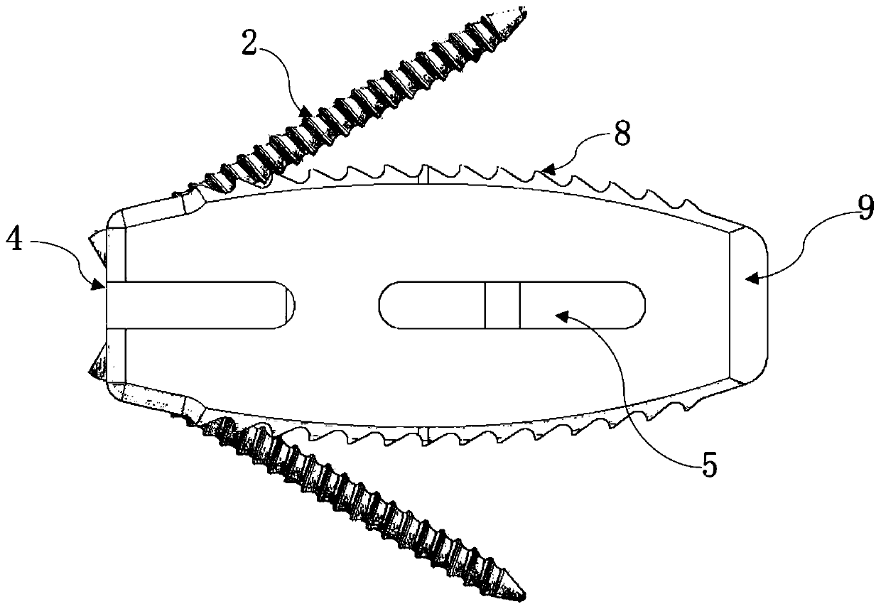 Posterior lumbar interbody fusion system