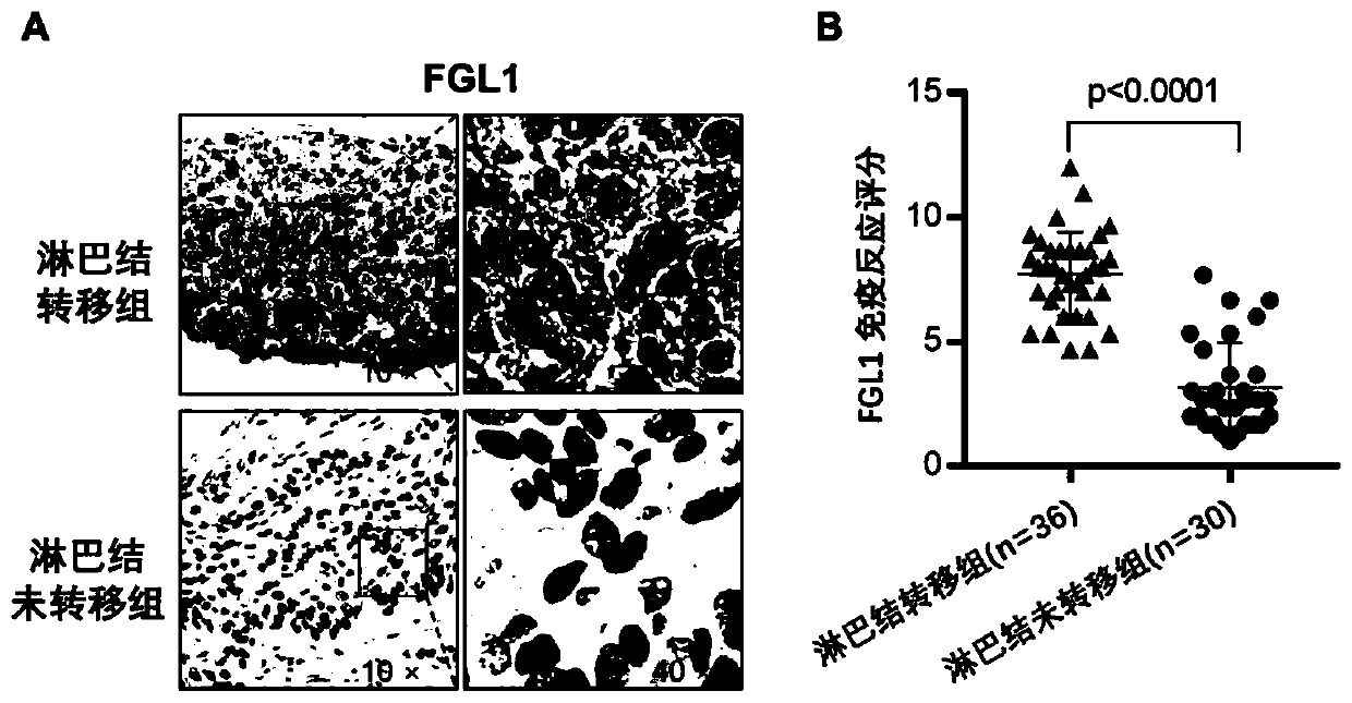 Application of FGL1 (fibrinogen like 1) in diagnosis and/or treatment on lymph node metastasis