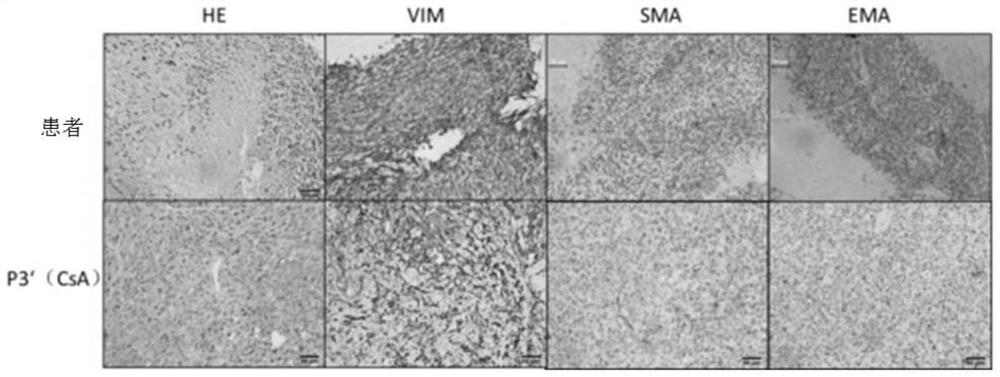 Construction method of an immunocompetent synovial sarcoma xenograft mouse model