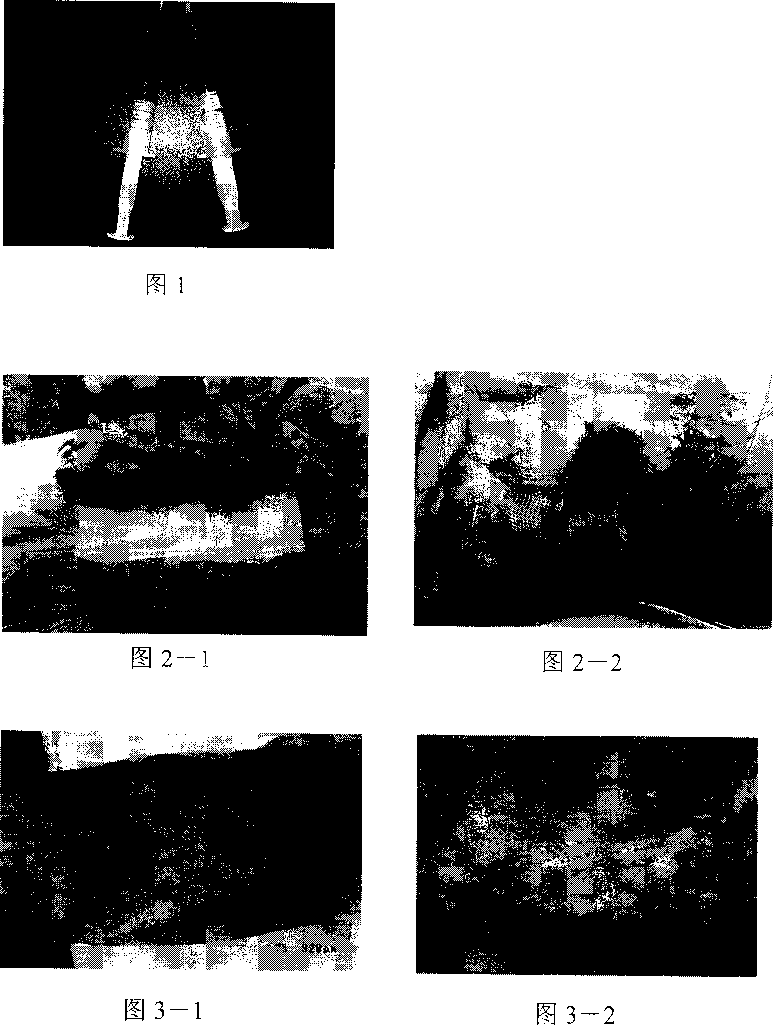 Tissue engineering composite skin material, and its preparing method