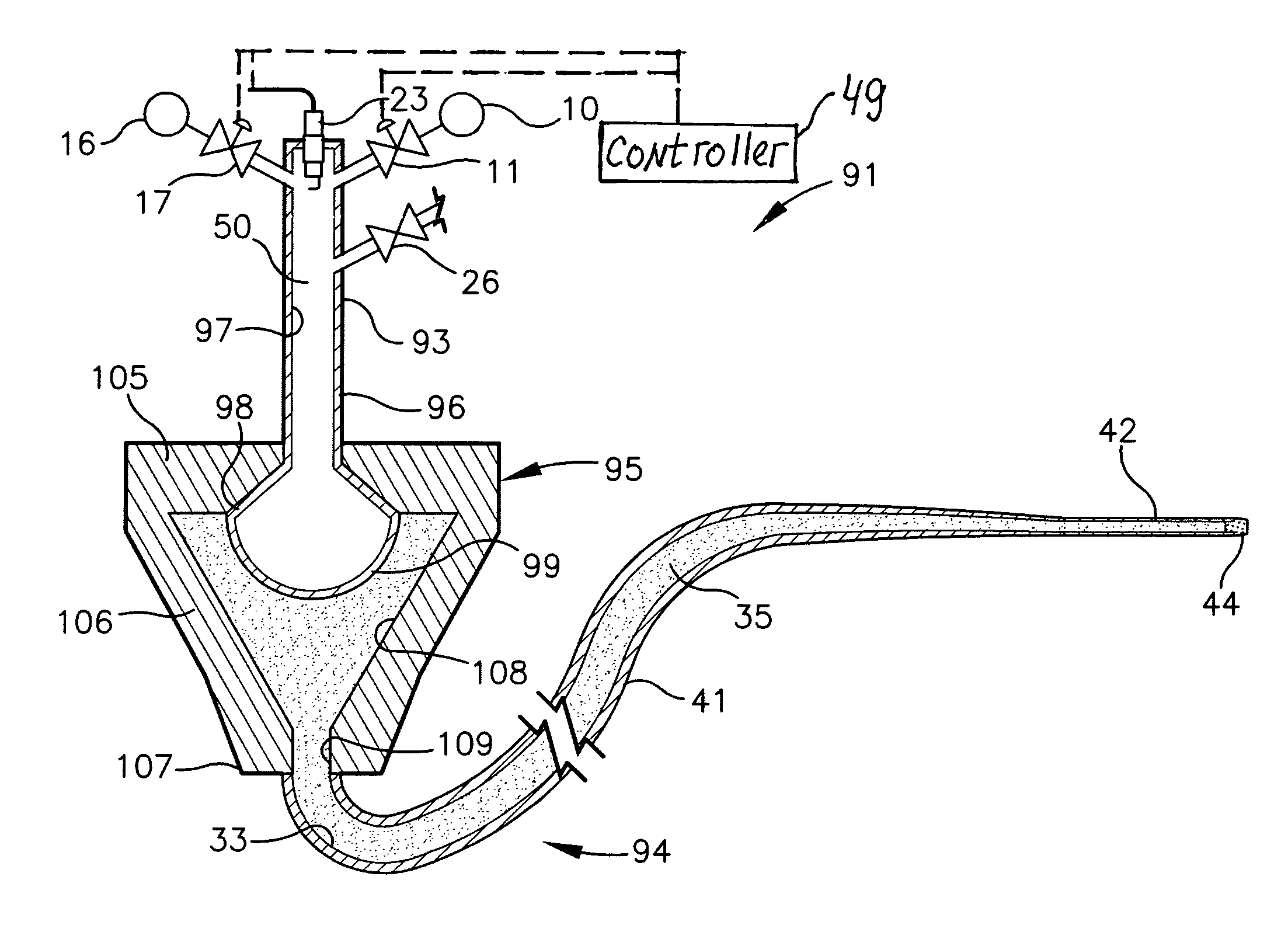 Stereotactic shockwave surgery and drug delivery apparatus